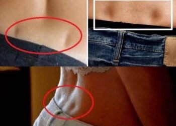 Если у вас есть эти два отверстия в пояснице, это означает…