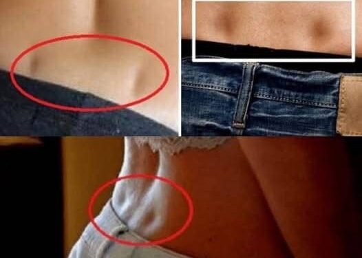 Если у вас есть эти два отверстия в пояснице, это означает…