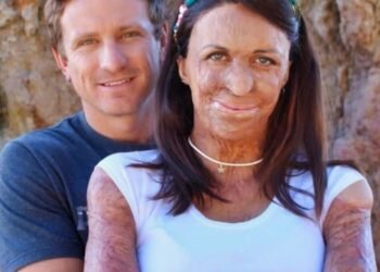 История молодой австралийской модели, выжившей после ада