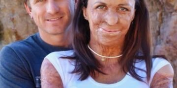 История молодой австралийской модели, выжившей после ада