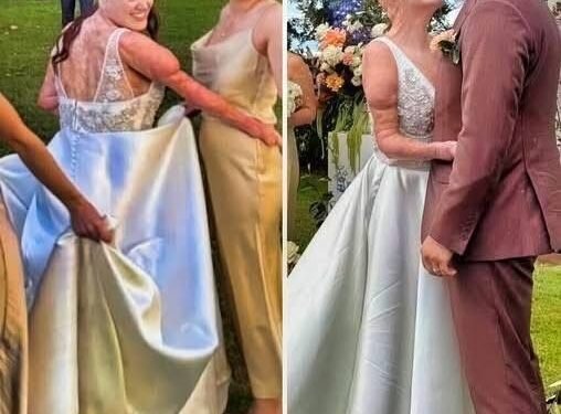 После страшной аварии эта девушка стала символом невероятной силы и мужества