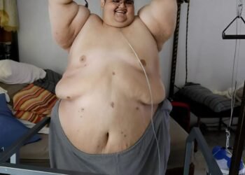 7 лет назад этот мужчина весил почти 595 кг