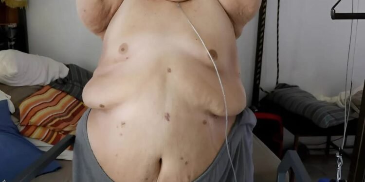 7 лет назад этот мужчина весил почти 595 кг