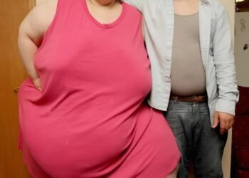 Два года назад эта женщина весила 350 кг, oна не могла ходить, принимать душ или готовить еду